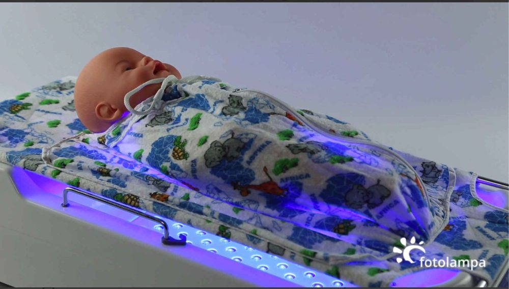 Прокат лампа від жовтяниці жовтухи новонароджених, лампа от желтушки
