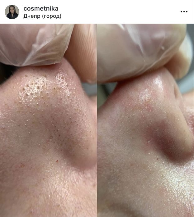 Косметолог  Лівий берег Дніпро