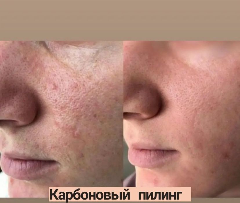 !Обучение косметолог - эстетист без мед образования !