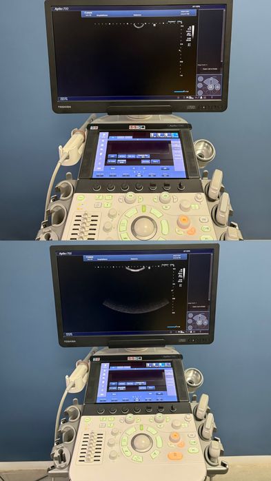 УЗД Toshiba Canon Aplio i700 Ультразвуковий апарат УЗИ сканер