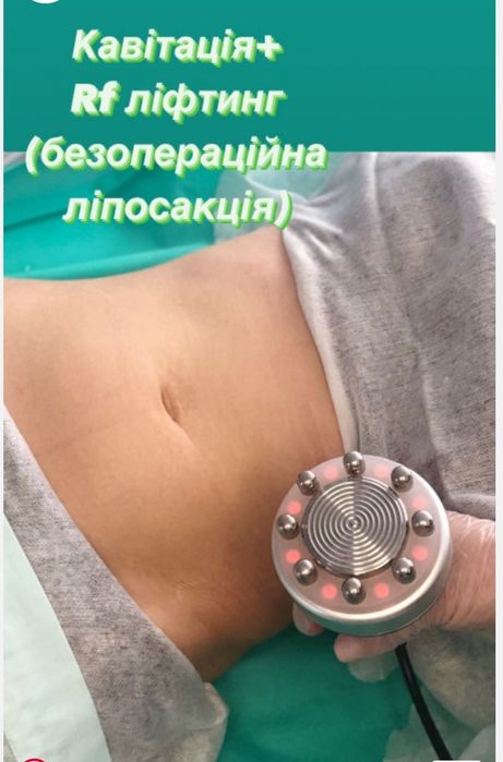 Уменьшение объемов тела