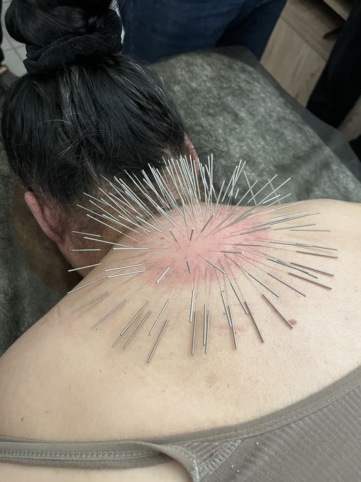 Массаж, хиджама, индустриальный, хтз