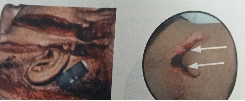 Uma espetacular obra para profissionais de Emergência Médica