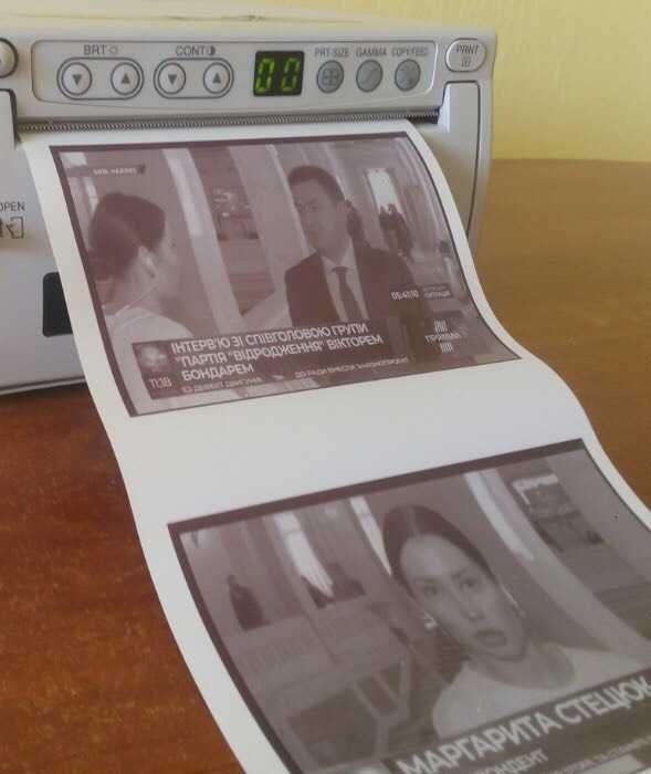 Відеопринтер Mitsubishi P91 для УЗД / іншого мед обладнання. Термодрук