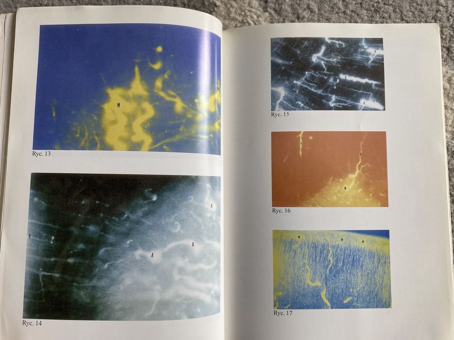 Wczesna diagnostyka i rehabilitacja dziecka