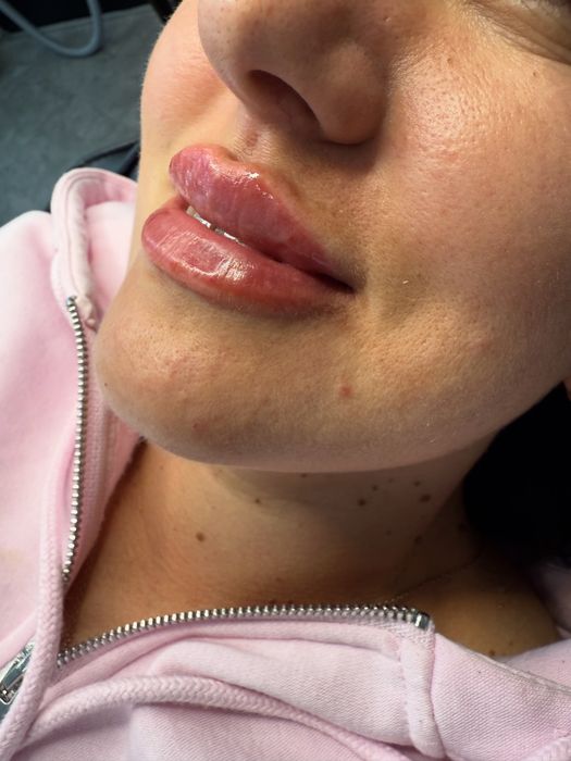 Збільшення губ. Потрібні моделі