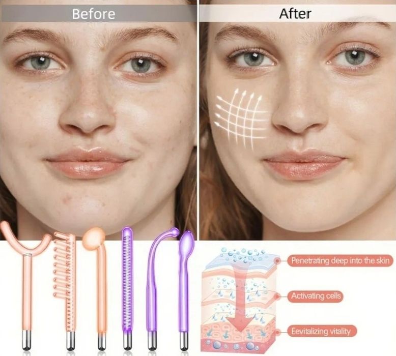 Profesjonalna Maszyna do pielegnacji skóry 6 Elektrod Neon/Argon