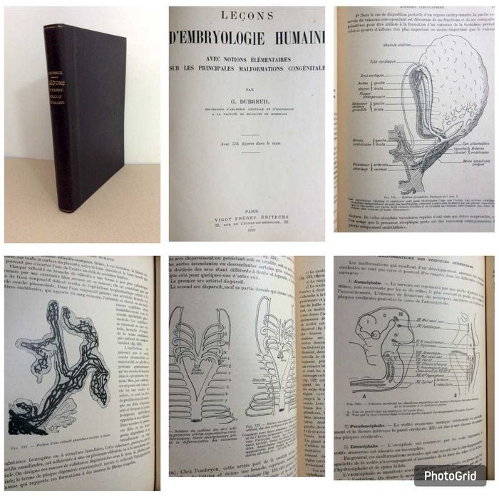Lote com 2 exemplares muito ilustrados com o tema: Embriologia humana.