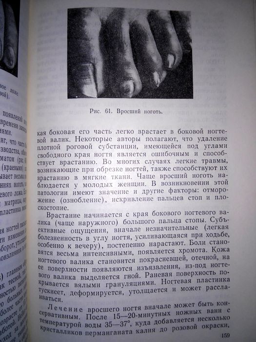 Шеклаков Болезни ногтей