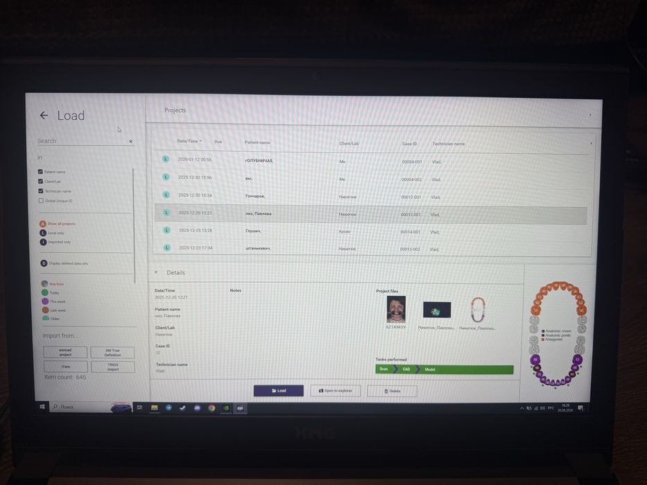 Ноутбук XMG A707 (N870HK1) з встановленим Exocad 3.0