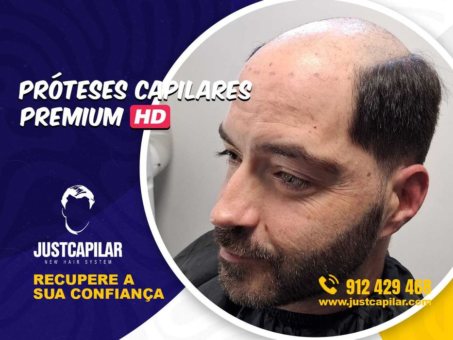 Prótese capilar Micro pele com colocação e corte, efeito real!