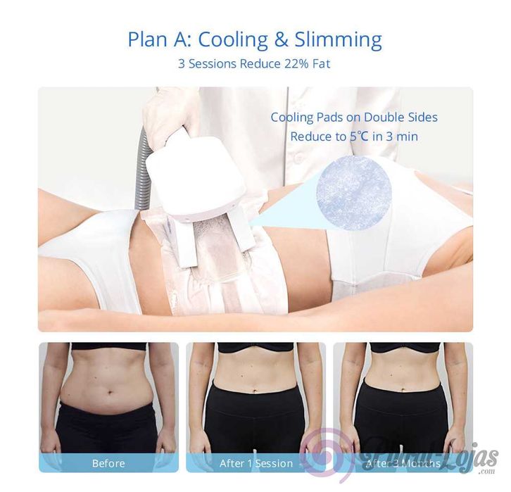 Maquina de Criolipolise Dupla + Cavitação + RF Corpo+ RF Rosto