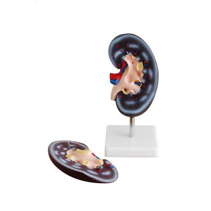 Model anatomiczny nerki