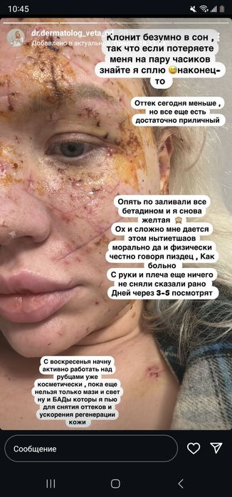 Лампа биоптрон Компакт цептер bioptron compact 3 zepter біоптрон