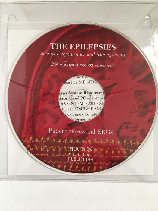 The Epilepsies: Seizures, Syndromes and Management