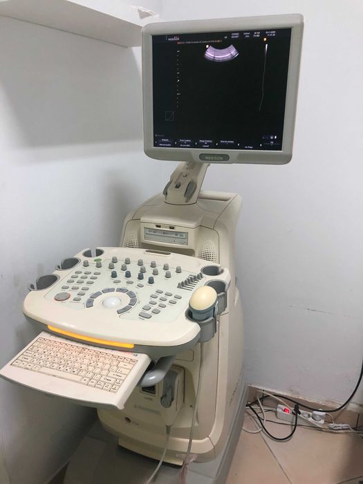 Ecógrafo Medison SonoAce X8 – Usado (Sem sondas)