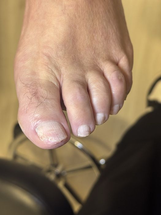 Manicure / pedicure / tratamento de micoses