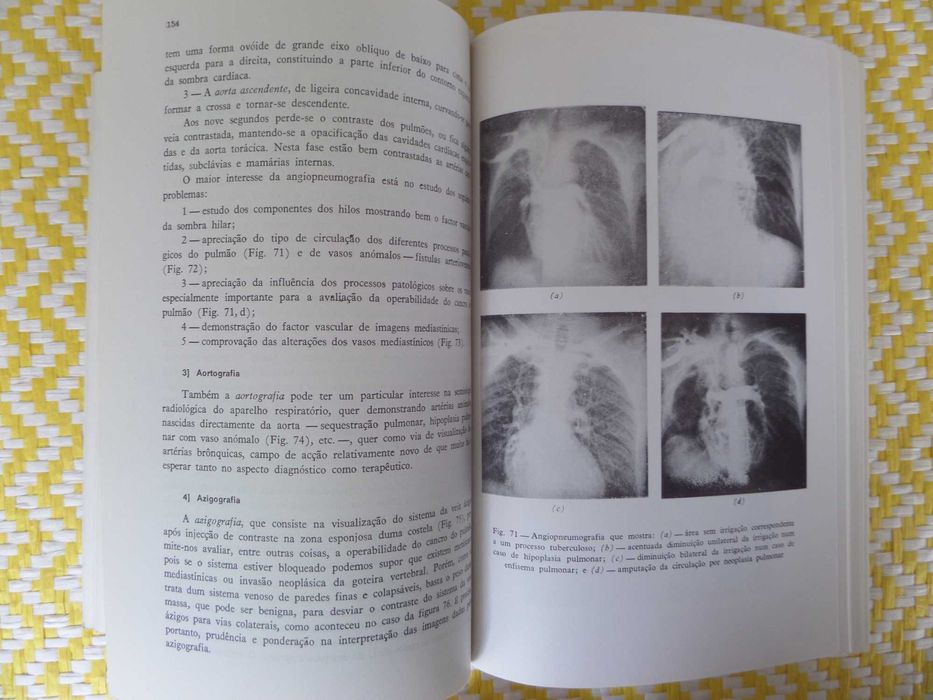 Propedêutica Médica
II Vol . Pneumologia