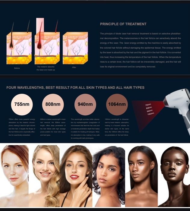 Laser diodowy 4 wiązkowy-depilacja laserowa