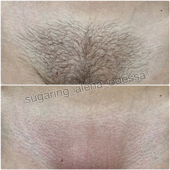 Шугаринг Воск Центр