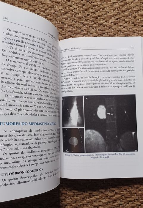 Medicina Temas Actuais - Pneumologia Clínica-IV
