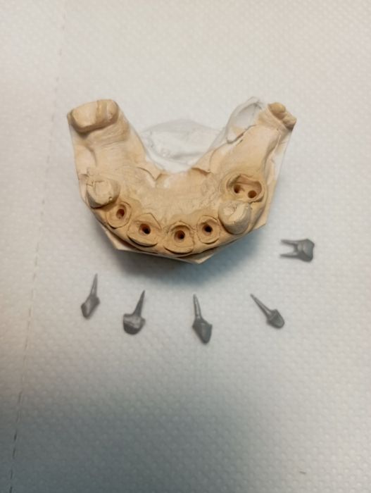 Зубний Технік /Металокераміст