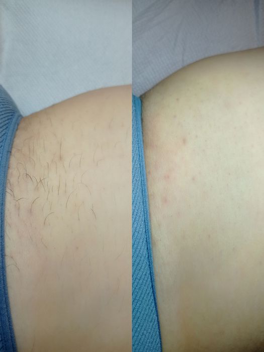 Депіляція воском/шугаринг Голосіївський