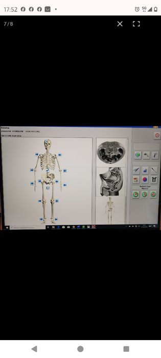 HUNTER 4025 Biorezonans Skaner i Terapia !