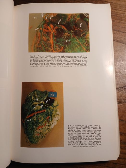 Arquivo de Anatomia e Antropologia, 1972