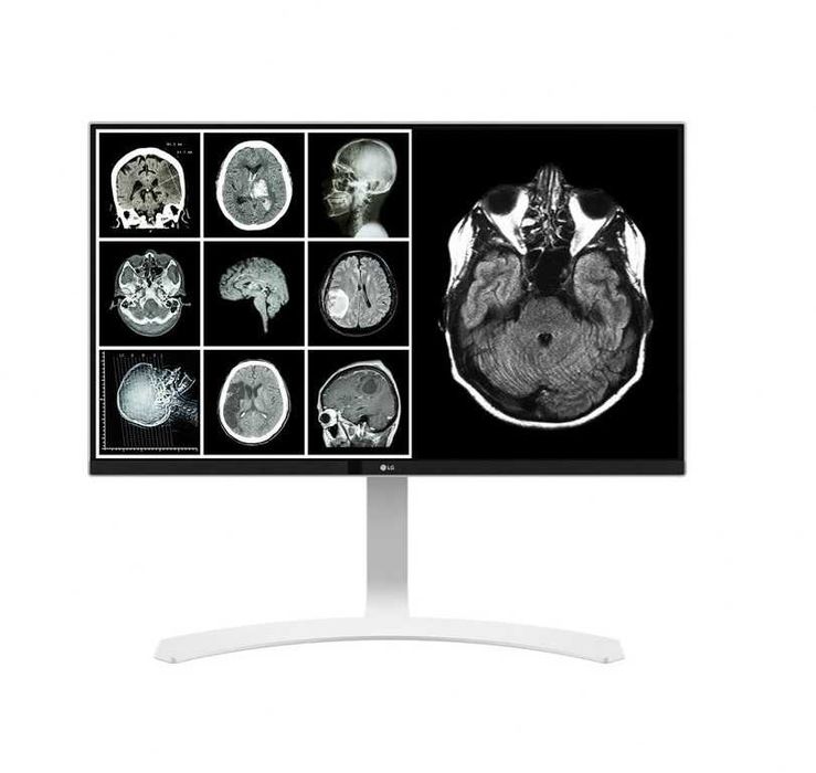 LG monitor 27 branco