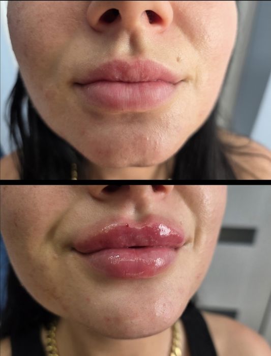 Promocja Borox 1 okolica 130zł