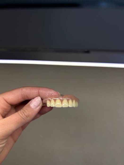 Пресовка інжекція нейлонових