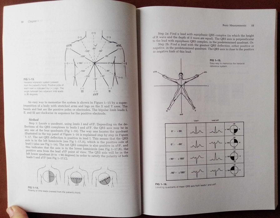 How to read Pediatric ECGs