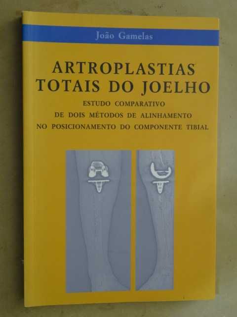 Artroplastias Totais do Joelho de João Gamelas