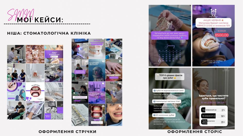 СММ, просування Instagram для стоматологів, бізнесу