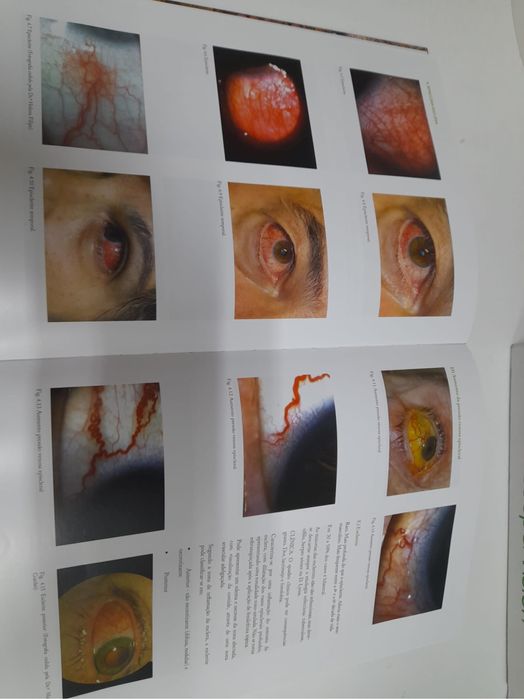 Atlas da Oftalmologia