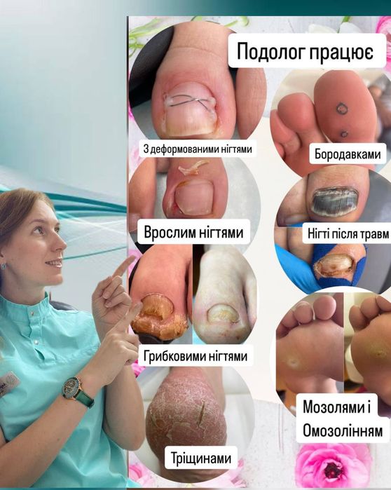 Подолог.Апаратний педикюр