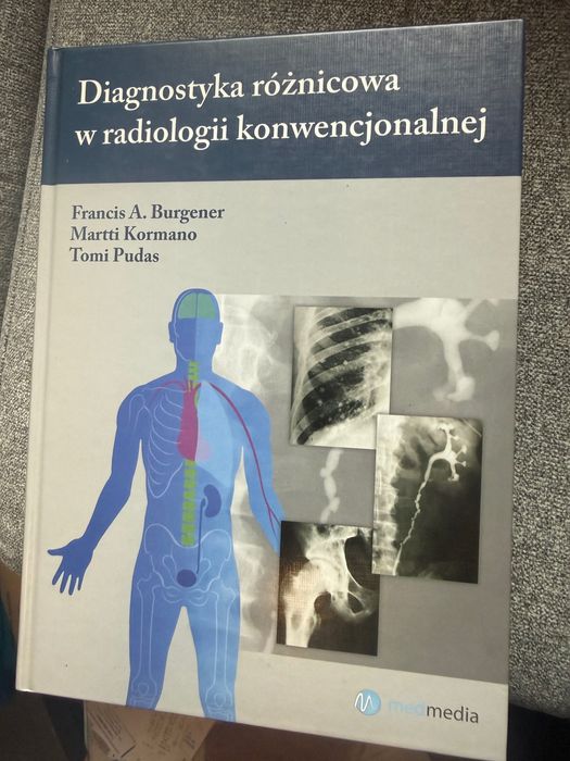 Diagnostyka różnicowa w radiologii konwencjonalnej Burgener