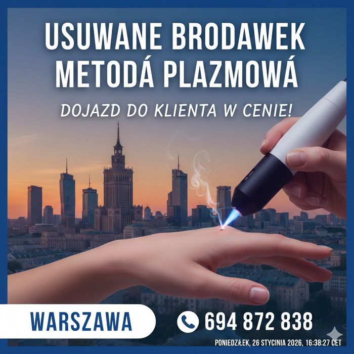 Usuwanie brodawek metodą plazmową