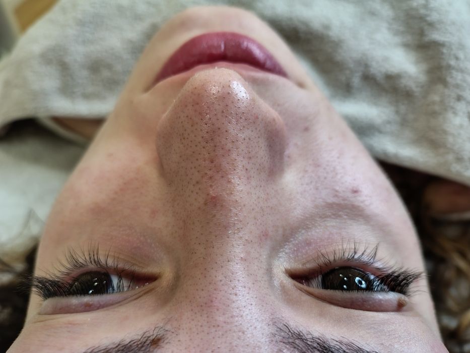 Limpeza de pele profunda