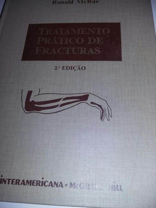 Tratamento prático de fraturas