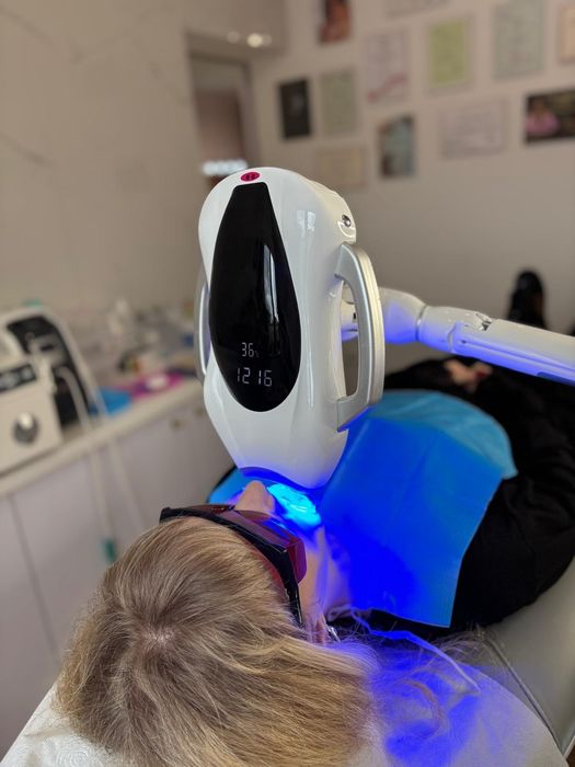 Kosmetyczne wybielanie zębów