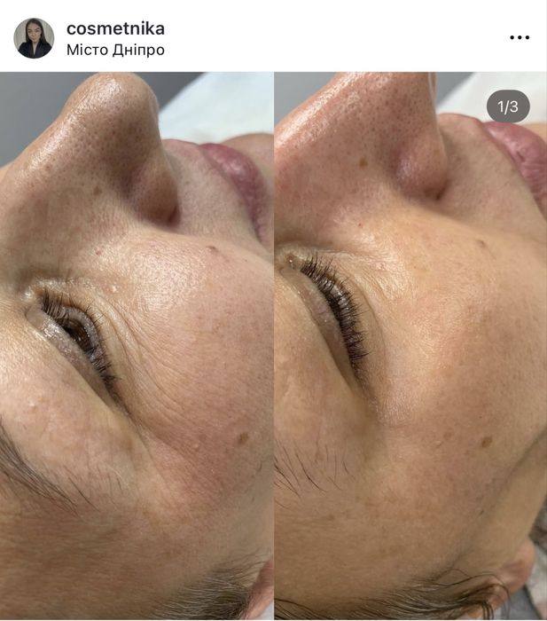 Косметолог  Лівий берег Дніпро