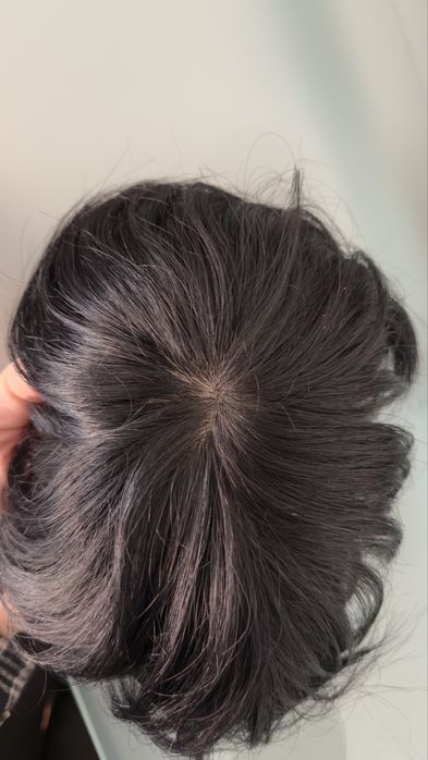 Prótese Capilar 100% Humano Ultra Realista Fios Injetados HIGH QUALITY