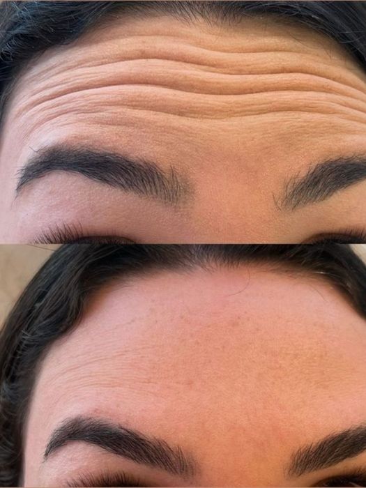 Приглашаю моделей  на косметологічні  послуги , для  съёмки  контенту.