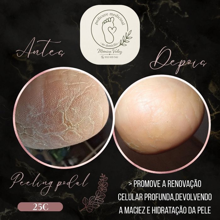 Apoio domiciliário e pedicure ao domicílio