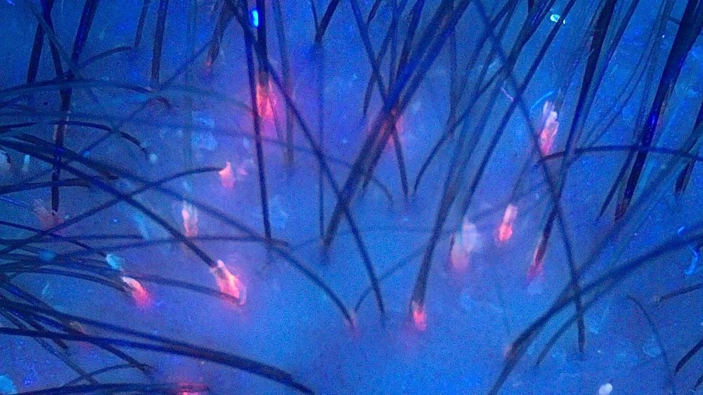 Badanie trichoskopowe w domu klienta