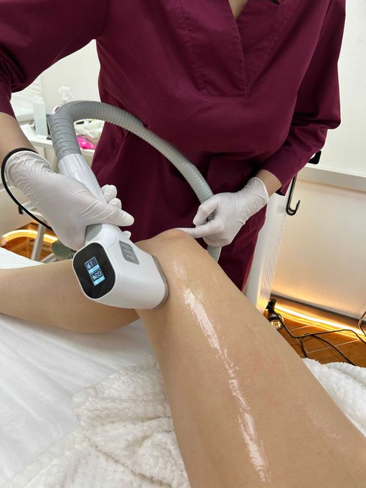 Лазерна епіляція, яка дійсно працює