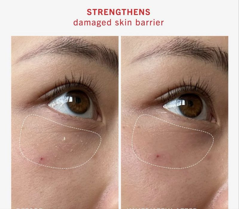 First aid beauty  ultra repair rescue skin barrier balm  63,7g