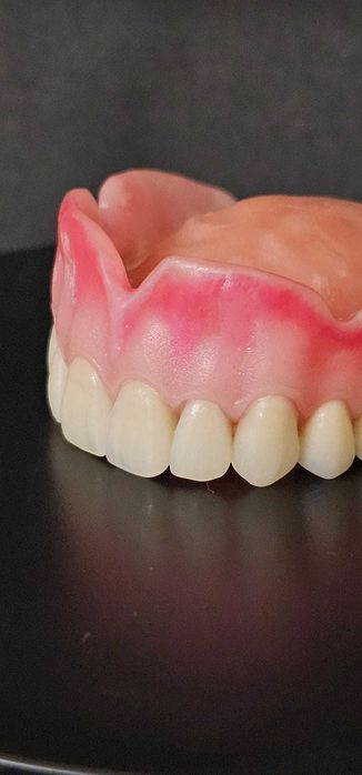 Próteses dentárias naturais